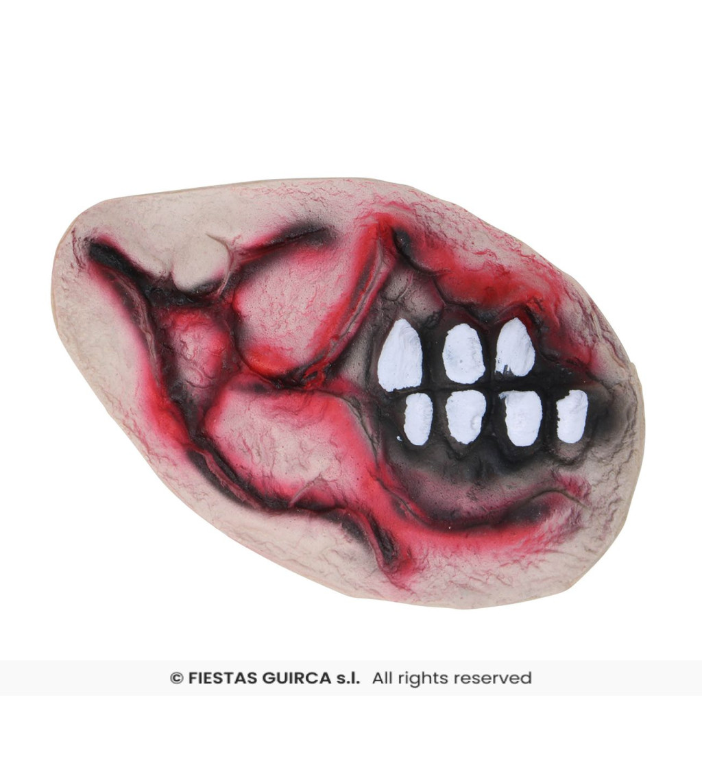 Latex sebhely – fél arc