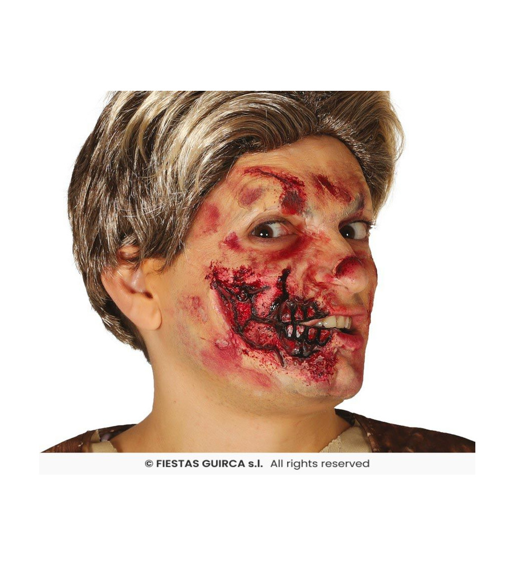 Latex sebhely – fél arc