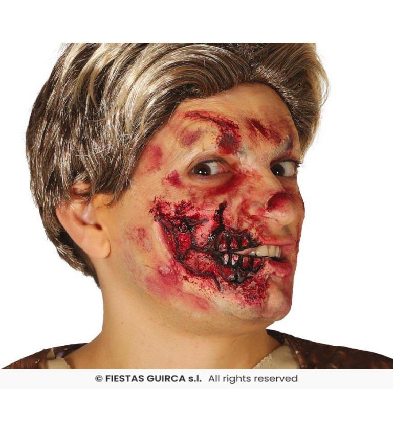 Latex sebhely – fél arc